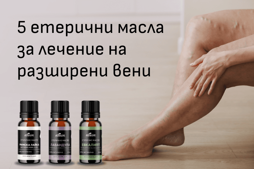 Етерични масла за разширени вени